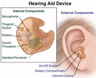 Illustrated drawing of a hearing aid