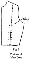 Fig. 3?Position of new dart