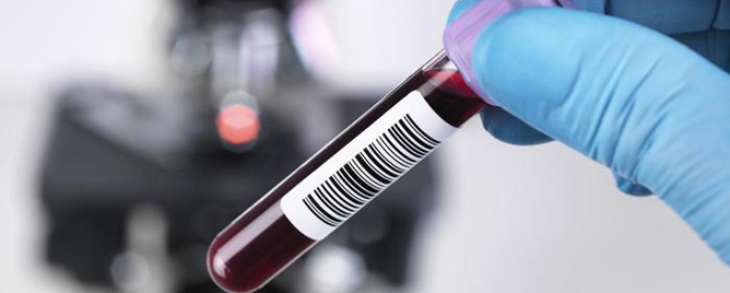 <br>A blood test could predict how blood samples could be used to anticipate how lung cancer patients may respond to treatments..... <a href='http://www.cancerresearchuk.org/about-us/cancer-news/press-release/2016-11-21-blood-test-could-predict-best-treatment-for-lung-cancer' target='_blank'>More</a>
